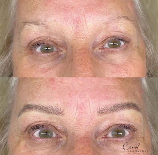Resultado antes e depois FEN 3