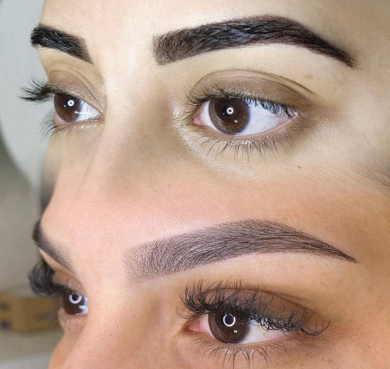 Resultado antes e depois FEN 4