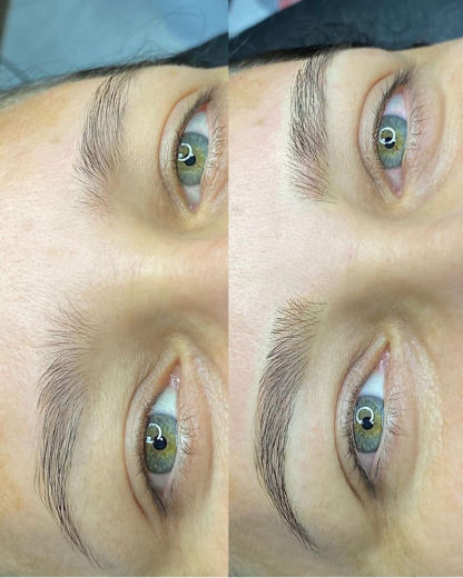 Resultado antes e depois FEN 5