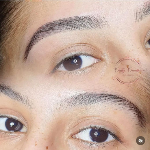 Resultado antes e depois FEN 6