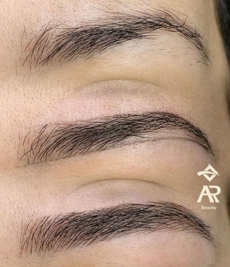 Resultado antes e depois FEN 7