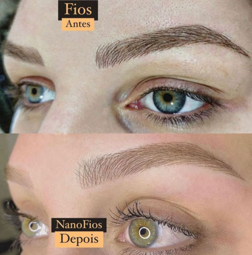 Resultado antes e depois FEN 8
