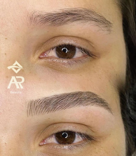 Resultado antes e depois FEN 9