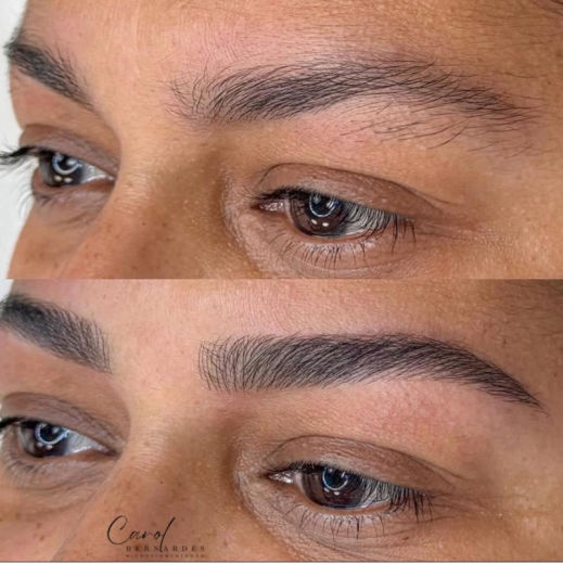 Resultado antes e depois FEN 10