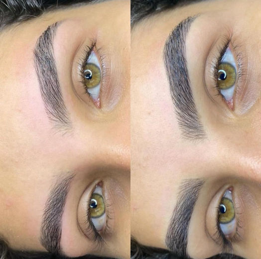 Resultado antes e depois FEN 11
