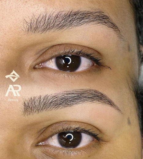 Resultado antes e depois FEN 12