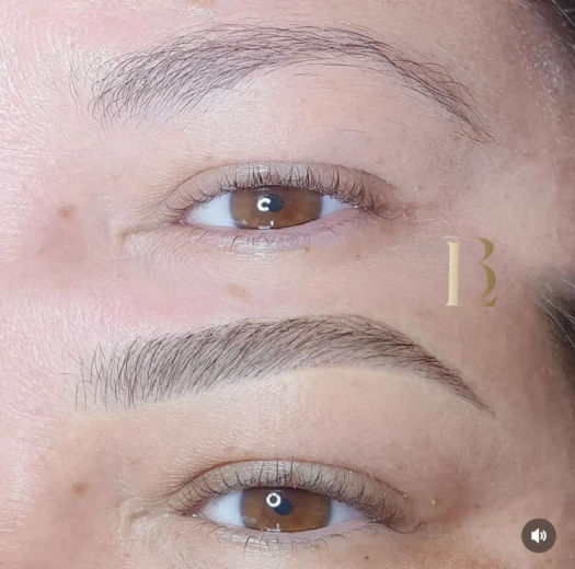 Resultado antes e depois FEN 14