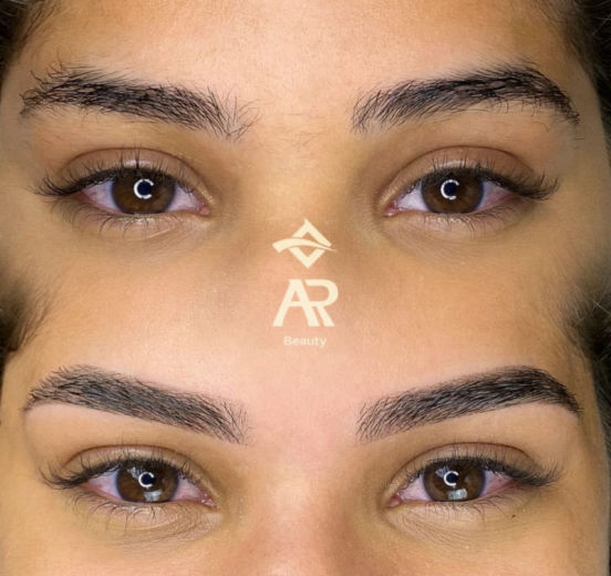 Resultado antes e depois FEN 15