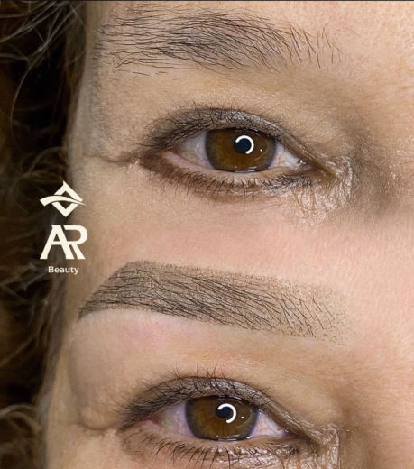 Resultado antes e depois FEN 16