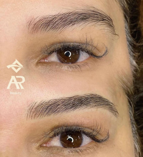 Resultado antes e depois FEN 17