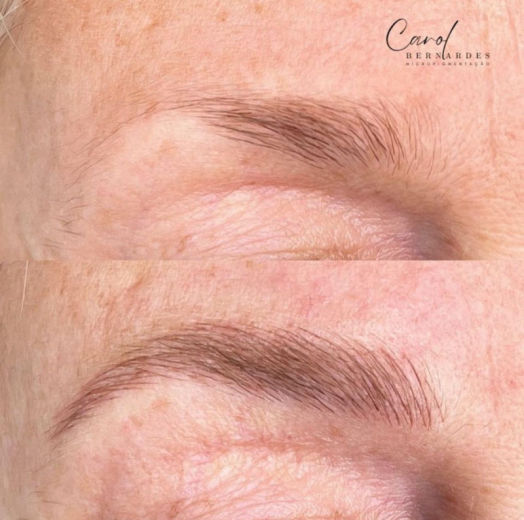 Resultado antes e depois FEN 18