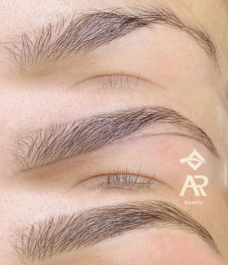 Resultado antes e depois FEN 19