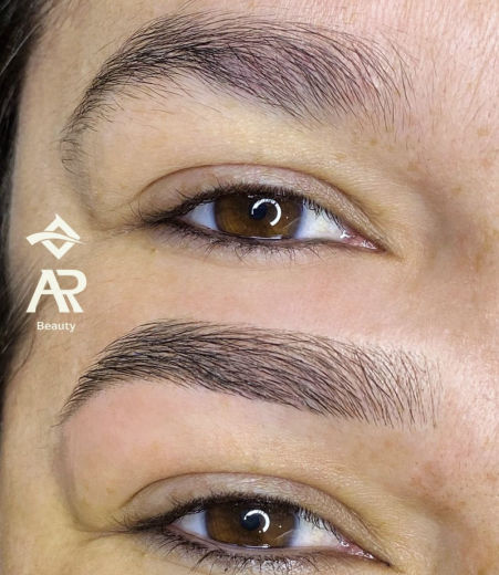Resultado antes e depois FEN 20