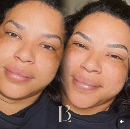 Resultado antes e depois FEN 21