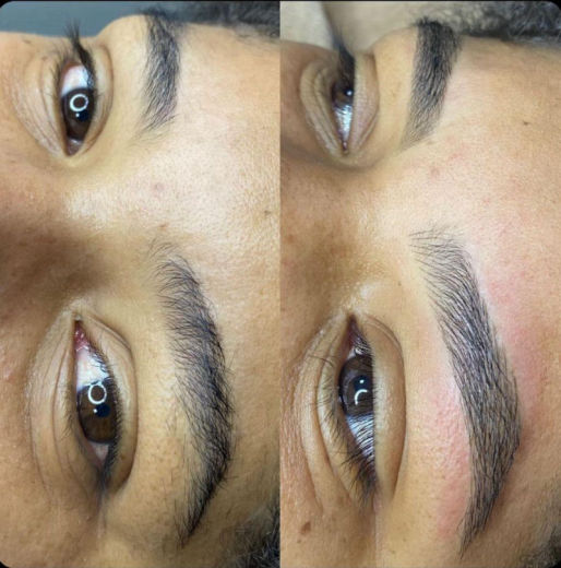 Resultado antes e depois FEN 24